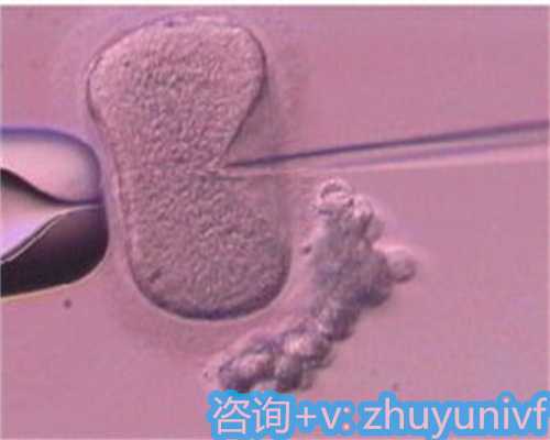 赴俄第三方助孕经历分享与指南
