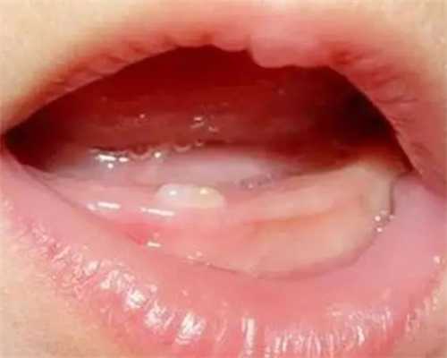 长沙助孕服务在十月幸孕：专业辅助生殖与优惠活动